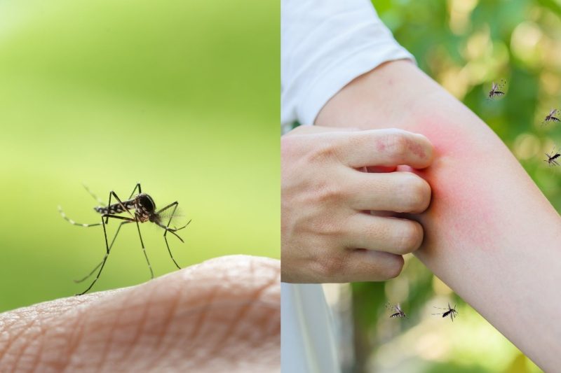 Štípance od komárov: Čo pomáha na svrbenie, opuch a kedy zbystriť pozornosť?